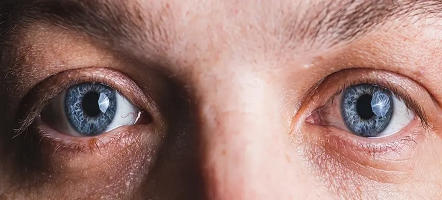 Blue Eyes: Shades, Facts and Styling Tips